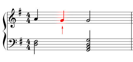 Antizipation Musikalische Fachbegriffe MusikLexikon